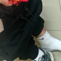 Жители ярославского Сарафоново сообщили о травме ребёнка на детской площадке