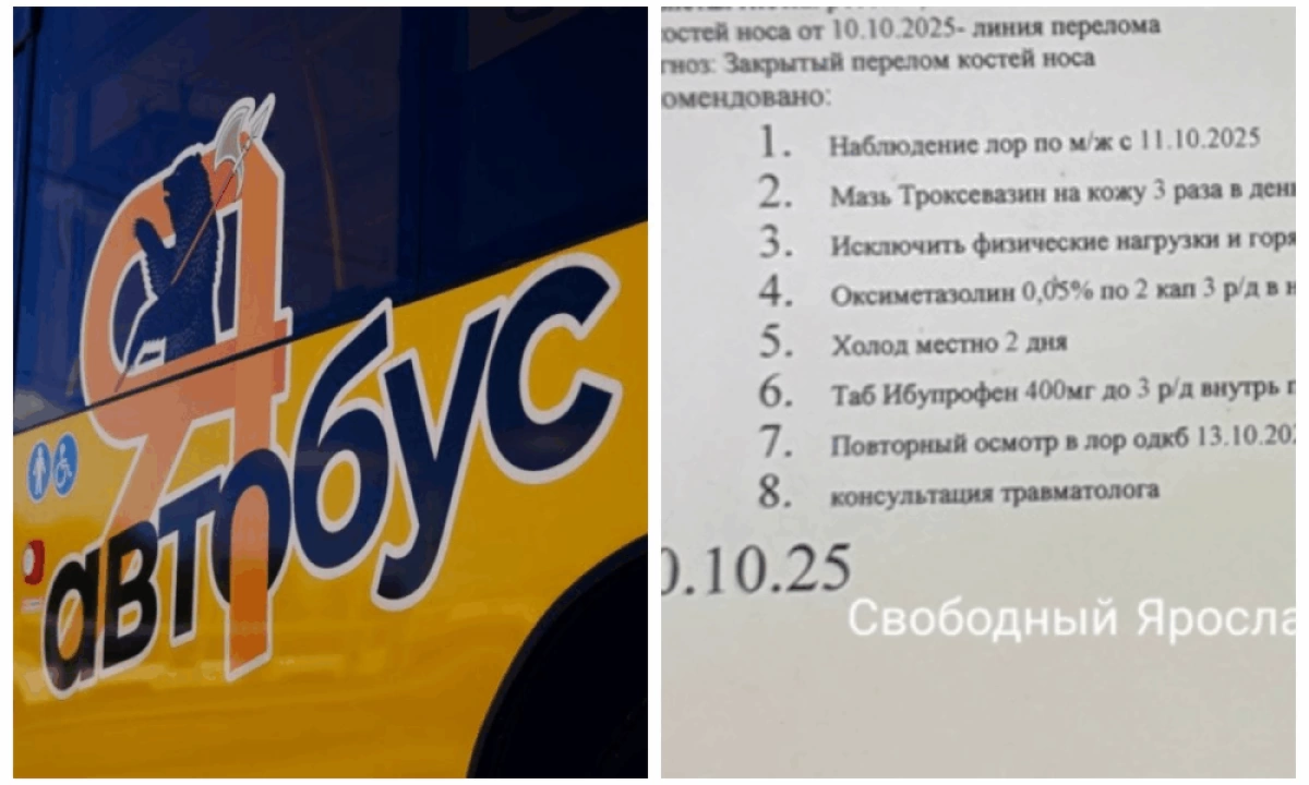 Жительница Ярославля сообщила о сломанном носе в «Яавтобусе» Жительница Ярославля сообщила о сломанном носе в «Яавтобусе»