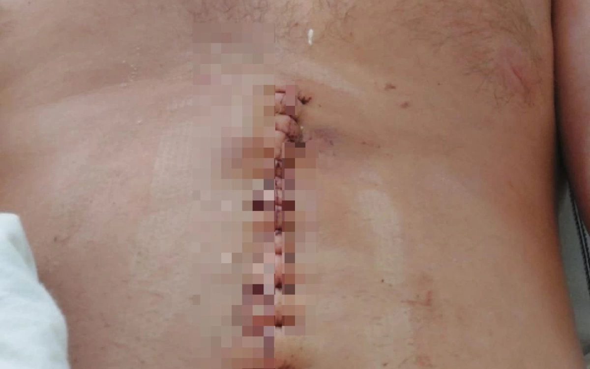 Вынесен приговор тутаевцу, ранившему ножом участника «Русской общины» Вынесен приговор тутаевцу, ранившему ножом участника «Русской общины»