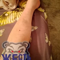 В Ярославле продолжаются жалобы на травмы в скользких автобусах