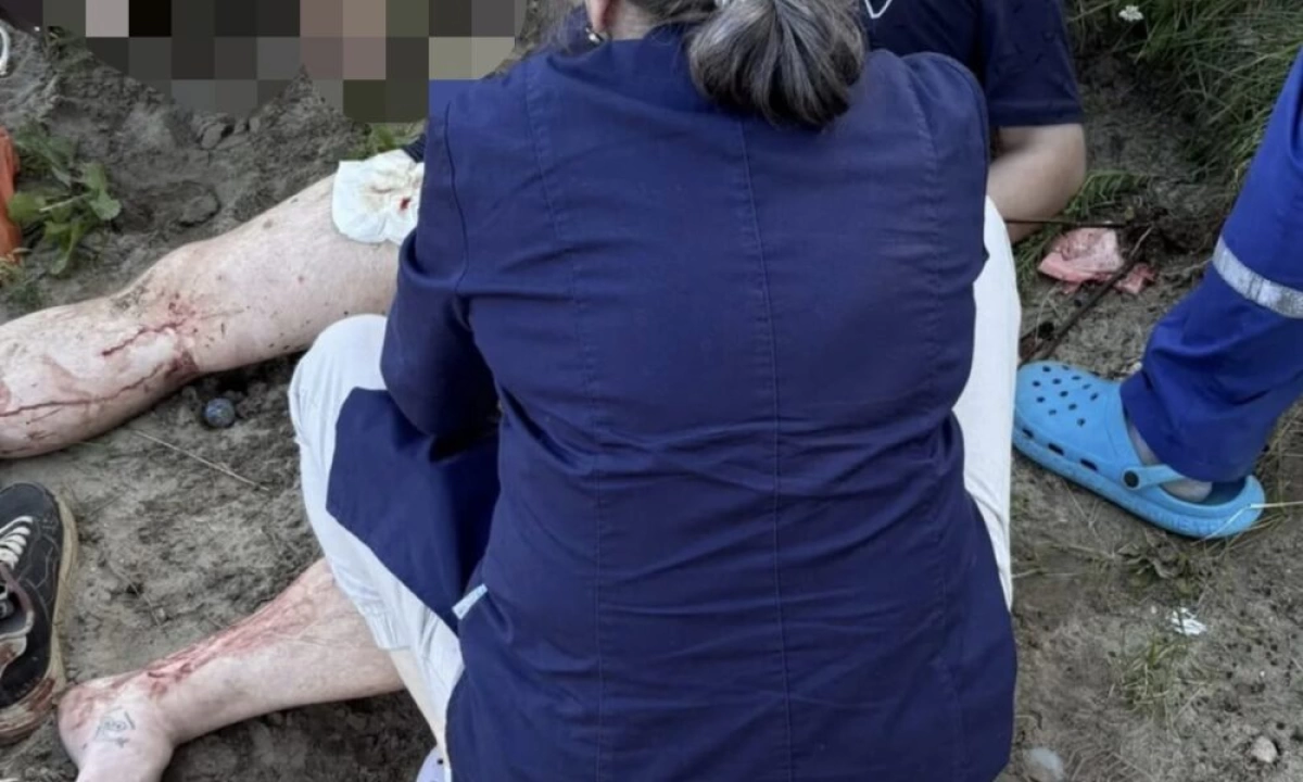 В Ярославле мужчина на пляже проколол ногу шампуром В Ярославле мужчина на пляже проколол ногу шампуром