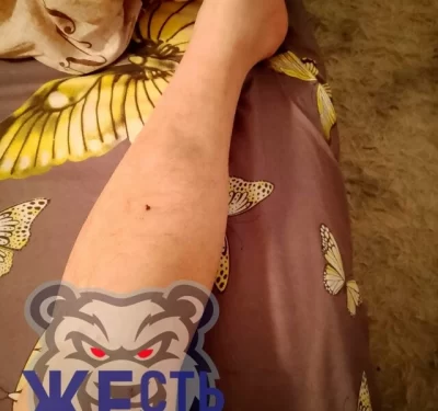 В Ярославле продолжаются жалобы на травмы в скользких автобусах