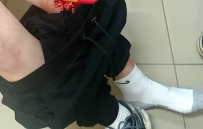 Ярославский СК проверяет инцидент с пострадавшим на детской площадке ребенком