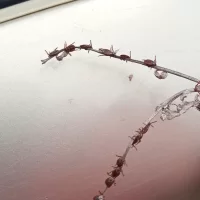 В Ярославской области зафиксировали 15 случаев укусов клещей